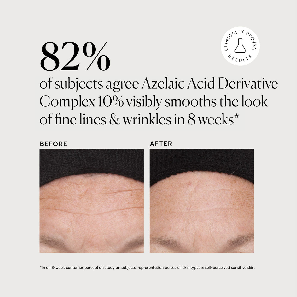 azelaic-acid-derivative-complex-10-jumbo-i7 NATR-10023-Alt-Images-Azelaic-Acid-Derivative-Complex-10_-043.jpg