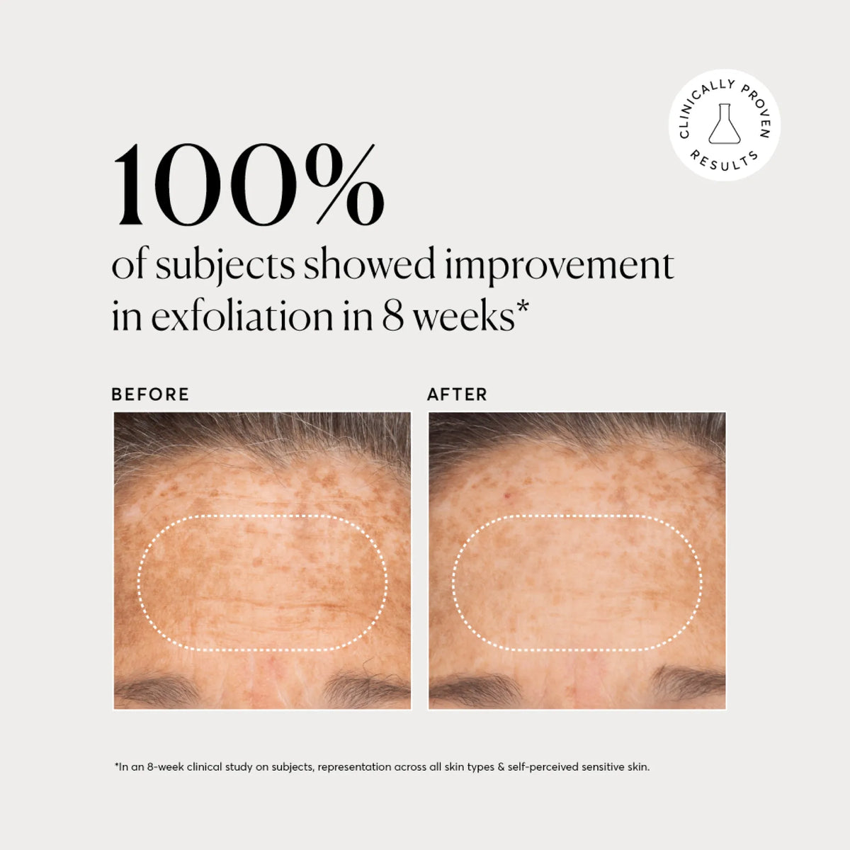 bha-liquid-exfoliant-2-g2 NATR-10027-Alt-Images-BHA-Liquid-Exfoliant-2_-03.webp